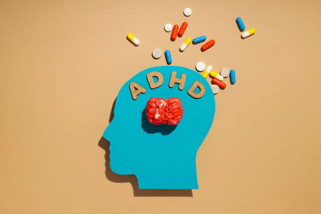 Nootropics for ADHD